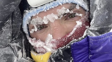 Первая помощь при обморожении: советы альпиниста